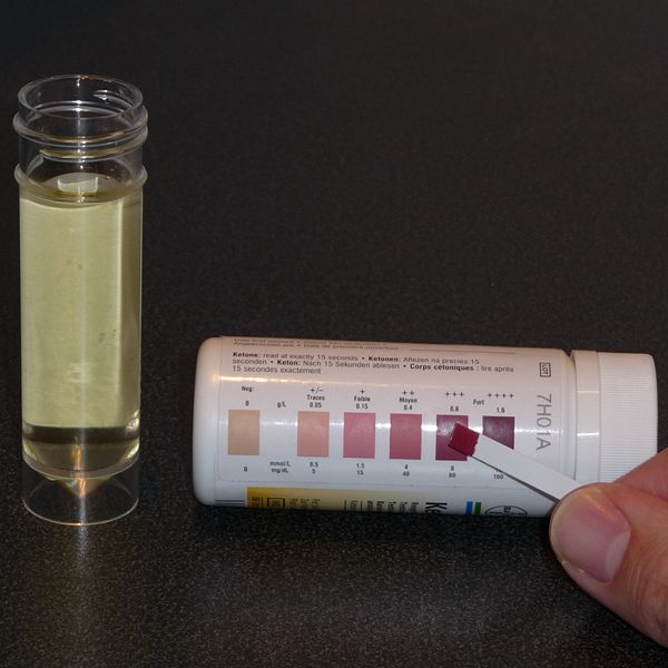 Urine testing for ketone levels